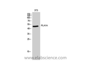 PLA1A Polyclonal Antibody