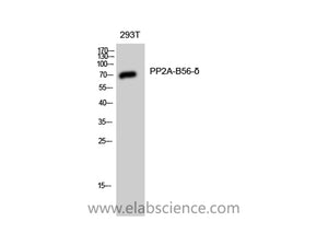 PPP2R5D Polyclonal Antibody