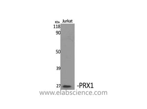 PRRX1 Polyclonal Antibody