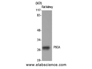 PSCA Polyclonal Antibody