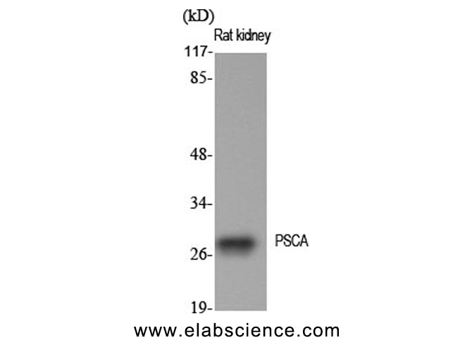 PSCA Polyclonal Antibody