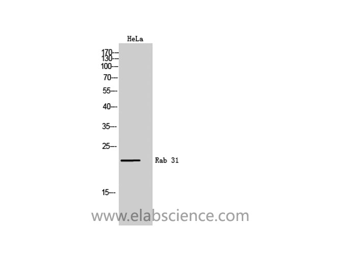 RAB31 Polyclonal Antibody