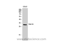 RAB6A Polyclonal Antibody