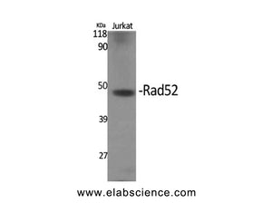 RAD52 Polyclonal Antibody