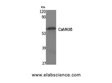 CAMK2D Polyclonal Antibody