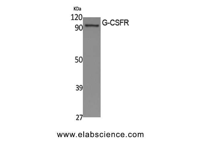 CSF3R Polyclonal Antibody