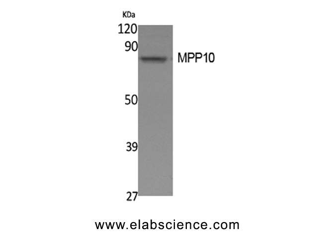 MPHOSPH10 Polyclonal Antibody