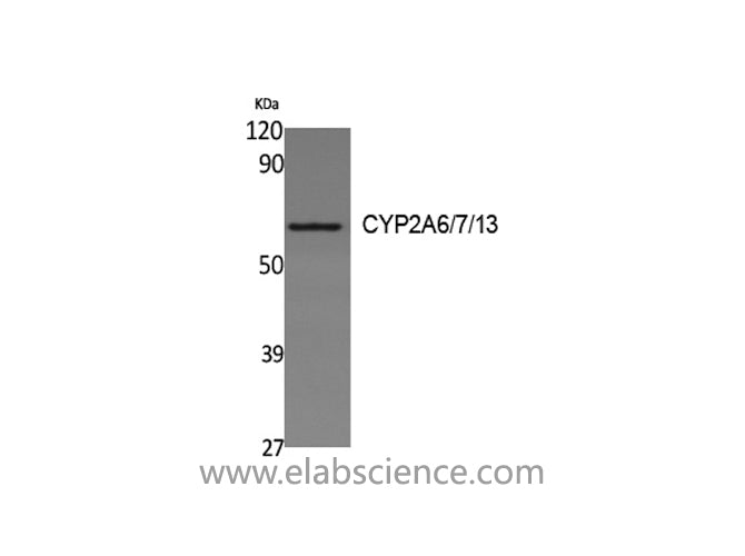 CYP2A6/7/13 Polyclonal Antibody