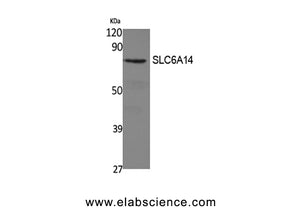 SLC6A14 Polyclonal Antibody