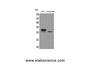 TREM1 Polyclonal Antibody