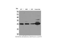 PGP 9.5 Polyclonal Antibody