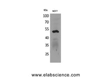CK-14 Polyclonal Antibody
