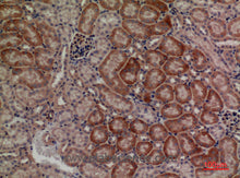 DUSP3 Polyclonal Antibody