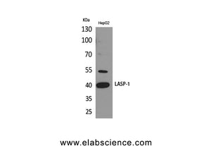 LASP1 Polyclonal Antibody