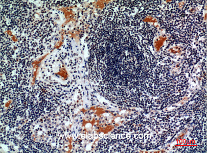 CD116 Polyclonal Antibody