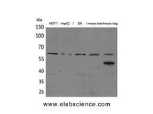 ZKSCAN4 Polyclonal Antibody