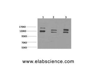 ADGRB1 Polyclonal Antibody
