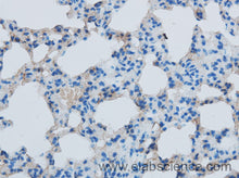EBI3 Polyclonal Antibody