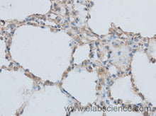 MMP1 Polyclonal Antibody