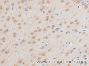 EIF5A2 Polyclonal Antibody