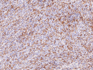 Anti-Hairy Cell Leukemia Monoclonal Antibody