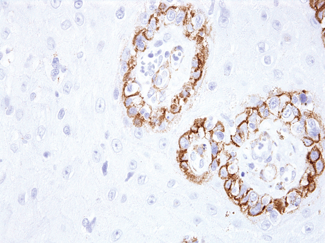Anti-KBA.62 (Melanoma Associated Antigen) Monoclonal Antibody