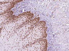 GeneAbTM MLH1 [IHC409] on Esophagus