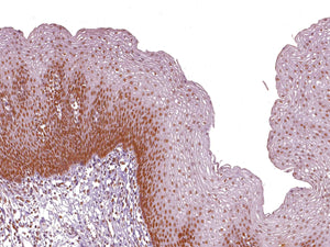 GeneAbTM MSH2 [IHC410] on Esophagus