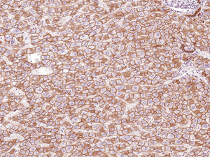 Anti-N-cadherin Monoclonal Antibody
