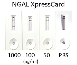 Human Neutrophil Gelatinase-Associated Lipocalin (NGAL) XpressCard (10 tests)