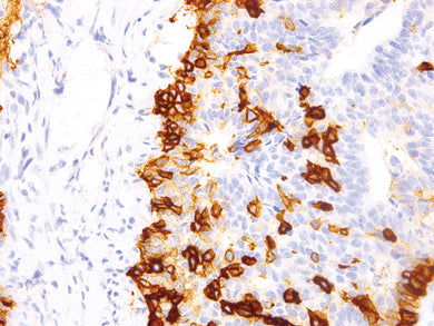 Anti-Nerve Growth Factor Receptor (NGFR) Monoclonal Antibody