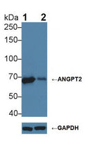 Anti-Angiopoietin 2 (ANGPT2)