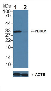 Anti-Programmed Cell Death Protein 1 (PDCD1)