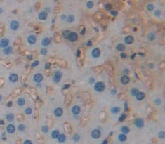Anti-B-Cell Leukemia/Lymphoma 2 (Bcl2)