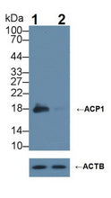 Anti-Acid Phosphatase 1 (ACP1)