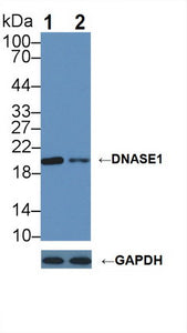 Anti-Deoxyribonuclease I (DNASE1)