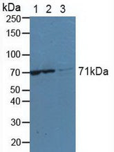Anti-Lysyl tRNA Synthetase (KARS)