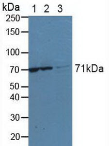 Anti-Lysyl tRNA Synthetase (KARS)