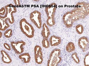 Anti-PSA Monoclonal Antibody
