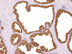 Anti-PSAP Monoclonal Antibody
