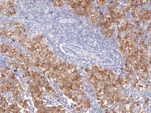 GeneAbTM Podoplanin [IHC650] on Testicular Cancer