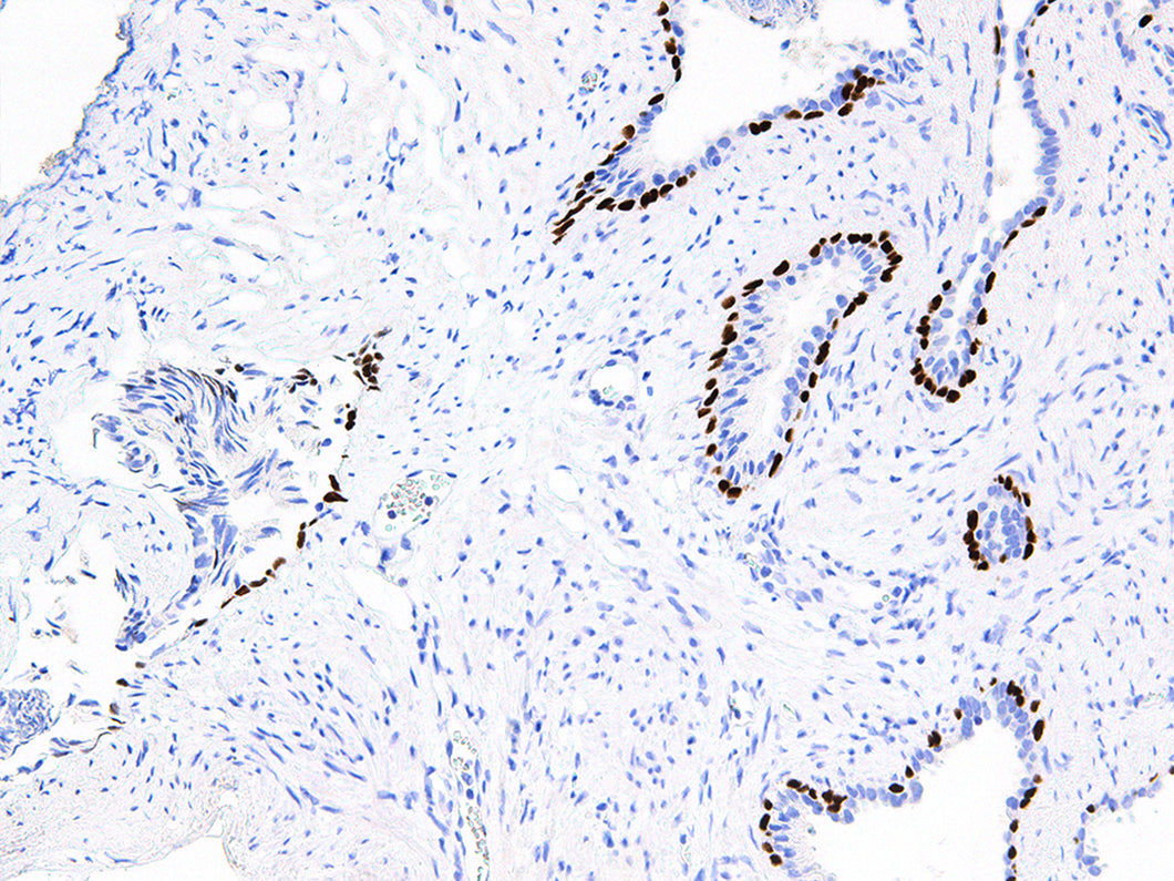 Anti p63 Monoclonal Antibody  (Newly Launched Product!!! Promotion Sale Till End of May 2019)